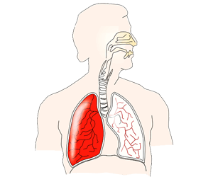 Chest & Throat